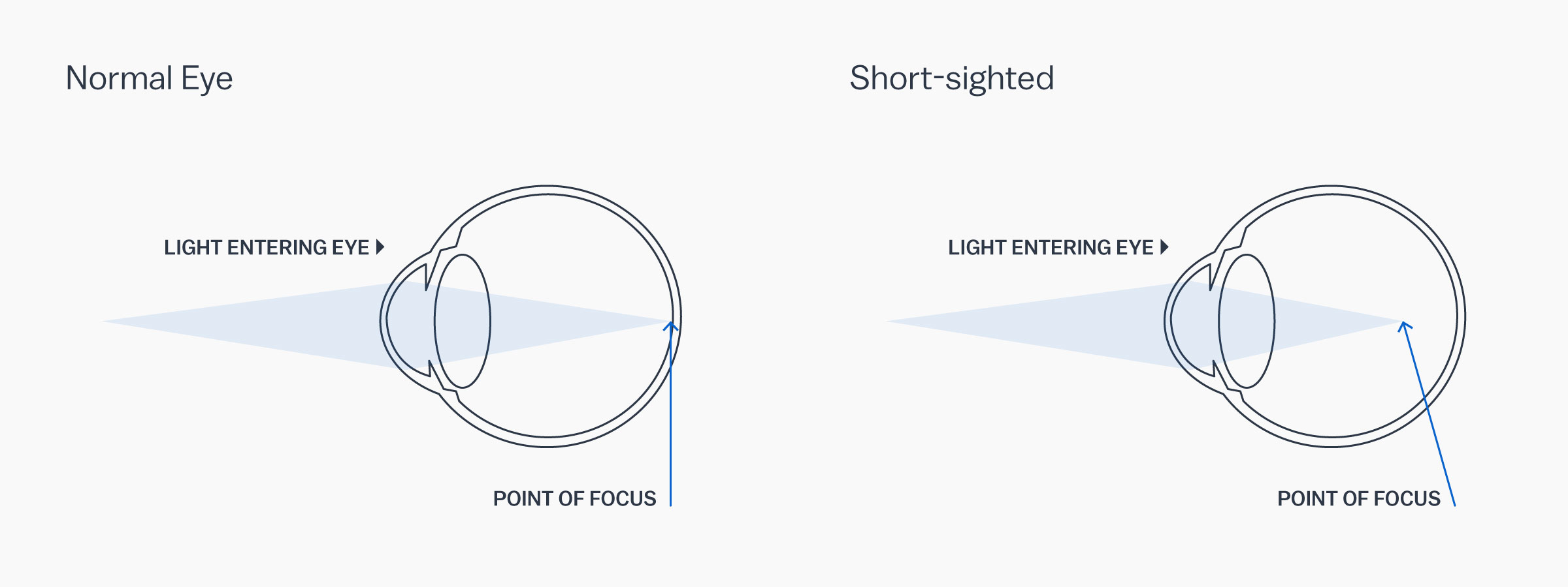 short sight glasses